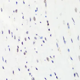 Anti-Histone H3R8me1 (mono-methyl Arg8) antibody used in IHC (Paraffin sections) (IHC-P). GTX54135