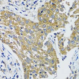 Anti-GOT1 antibody used in IHC (Paraffin sections) (IHC-P). GTX54155