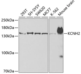 Anti-Kv11.1 antibody used in Western Blot (WB). GTX54285