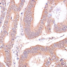 Anti-Kv11.1 antibody used in IHC (Paraffin sections) (IHC-P). GTX54285
