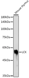Anti-Lck antibody used in Western Blot (WB). GTX54287