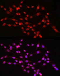 Anti-Lamin B1 antibody used in Immunocytochemistry/ Immunofluorescence (ICC/IF). GTX54288