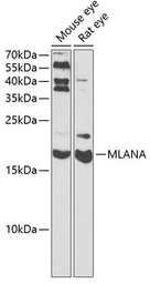Anti-Melan A antibody used in Western Blot (WB). GTX54303