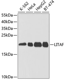 Anti-LITAF antibody used in Western Blot (WB). GTX54315