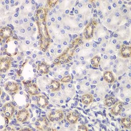 Anti-KEAP1 antibody used in IHC (Paraffin sections) (IHC-P). GTX54329