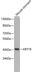Anti-Cytokeratin 19 antibody used in Western Blot (WB). GTX54330