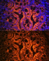 Anti-Cytokeratin 19 antibody used in IHC (Paraffin sections) (IHC-P). GTX54330