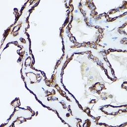 Anti-Cytokeratin 19 antibody used in IHC (Paraffin sections) (IHC-P). GTX54330