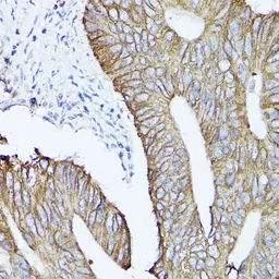 Anti-Cytokeratin 19 antibody used in IHC (Paraffin sections) (IHC-P). GTX54330