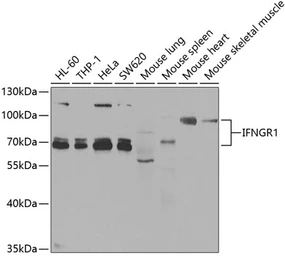 Anti-Interferon gamma Receptor 1 antibody used in Western Blot (WB). GTX54333