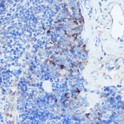 Anti-Interferon gamma Receptor 1 antibody used in IHC (Paraffin sections) (IHC-P). GTX54333