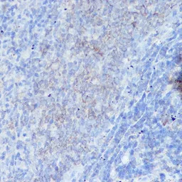 Anti-Interferon gamma Receptor 1 antibody used in IHC (Paraffin sections) (IHC-P). GTX54333