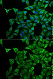 Anti-Cytokeratin 20 antibody used in Immunocytochemistry/ Immunofluorescence (ICC/IF). GTX54340