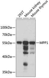 Anti-MPP1 antibody used in Western Blot (WB). GTX54346