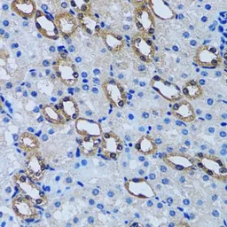 Anti-IMPA1 antibody used in IHC (Paraffin sections) (IHC-P). GTX54348