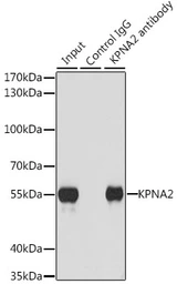 Anti-KPNA2 antibody used in Immunoprecipitation (IP). GTX54349