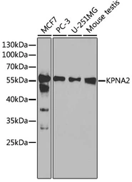 Anti-KPNA2 antibody used in Western Blot (WB). GTX54349