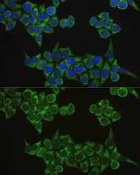 Anti-IRF3 antibody used in Immunocytochemistry/ Immunofluorescence (ICC/IF). GTX54366