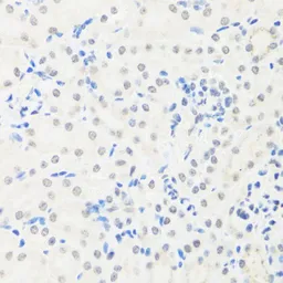 Anti-IRF3 antibody used in IHC (Paraffin sections) (IHC-P). GTX54366