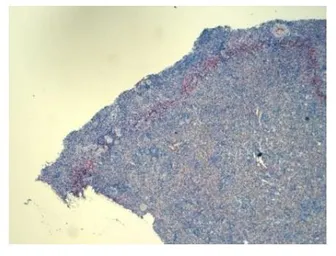 Anti-OLR1 / LOX-1 antibody [23C11] used in IHC (Paraffin sections) (IHC-P). GTX54456