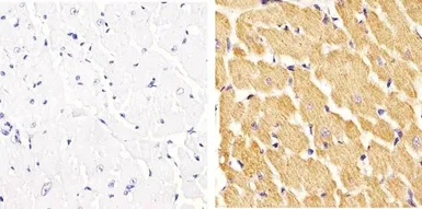 Anti-Vinculin (phospho Tyr822) antibody used in IHC (Paraffin sections) (IHC-P). GTX54519