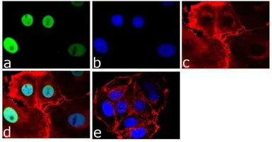 Anti-GATA3 antibody used in Immunocytochemistry/ Immunofluorescence (ICC/IF). GTX54527