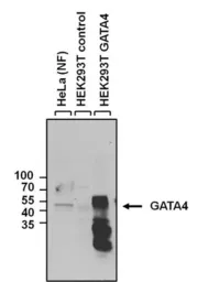 Anti-GATA4 antibody used in Western Blot (WB). GTX54530