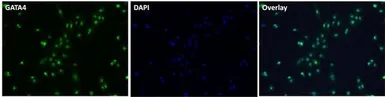 Anti-GATA4 antibody used in Immunocytochemistry/ Immunofluorescence (ICC/IF). GTX54530