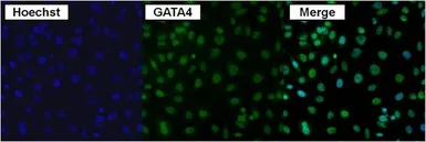 Anti-GATA4 antibody used in Immunocytochemistry/ Immunofluorescence (ICC/IF). GTX54530