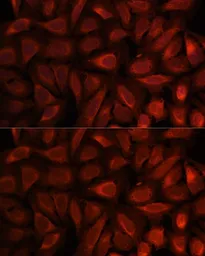 Anti-RKIP antibody used in Immunocytochemistry/ Immunofluorescence (ICC/IF). GTX54574