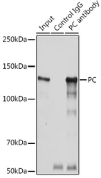 Anti-Pyruvate Carboxylase antibody used in Immunoprecipitation (IP). GTX54577