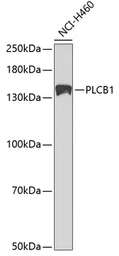 Anti-PLCB1 antibody used in Western Blot (WB). GTX54594