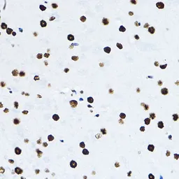 Anti-p54nrb antibody used in IHC (Paraffin sections) (IHC-P). GTX54596