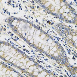 Anti-PLGF antibody used in IHC (Paraffin sections) (IHC-P). GTX54606
