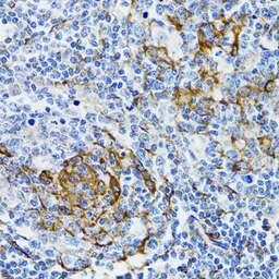 Anti-PGRMC1 antibody used in IHC (Paraffin sections) (IHC-P). GTX54607