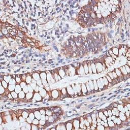 Anti-PIGR antibody used in IHC (Paraffin sections) (IHC-P). GTX54608