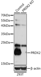 Anti-PRX II antibody used in Western Blot (WB). GTX54610