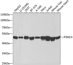 Anti-PSMC4 antibody used in Western Blot (WB). GTX54612
