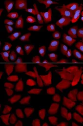 Anti-PSMC4 antibody used in Immunocytochemistry/ Immunofluorescence (ICC/IF). GTX54612