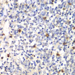 Anti-PSMD7 antibody used in IHC (Paraffin sections) (IHC-P). GTX54625