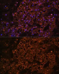 Anti-PCK1 antibody used in IHC (Paraffin sections) (IHC-P). GTX54629