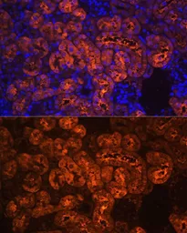 Anti-PCK1 antibody used in IHC (Paraffin sections) (IHC-P). GTX54629