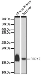 Anti-Peroxiredoxin 5 antibody used in Western Blot (WB). GTX54632
