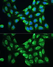 Anti-Peroxiredoxin 5 antibody used in Immunocytochemistry/ Immunofluorescence (ICC/IF). GTX54632