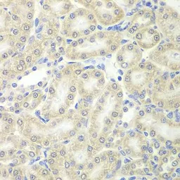Anti-Peroxiredoxin 5 antibody used in IHC (Paraffin sections) (IHC-P). GTX54632