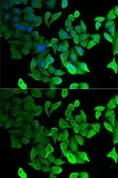 Anti-Septin 2 antibody used in Immunocytochemistry/ Immunofluorescence (ICC/IF). GTX54669