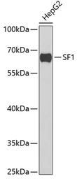 Anti-Splicing factor 1 antibody used in Western Blot (WB). GTX54670