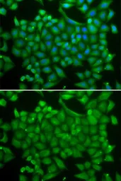 Anti-Rab11A antibody used in Immunocytochemistry/ Immunofluorescence (ICC/IF). GTX54678