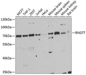 Anti-HCE antibody used in Western Blot (WB). GTX54686