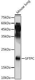 Anti-SFTPC antibody used in Western Blot (WB). GTX54694